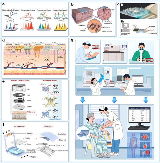 4A tetrahedron system for panvascular intervention empowered by flexible electronics