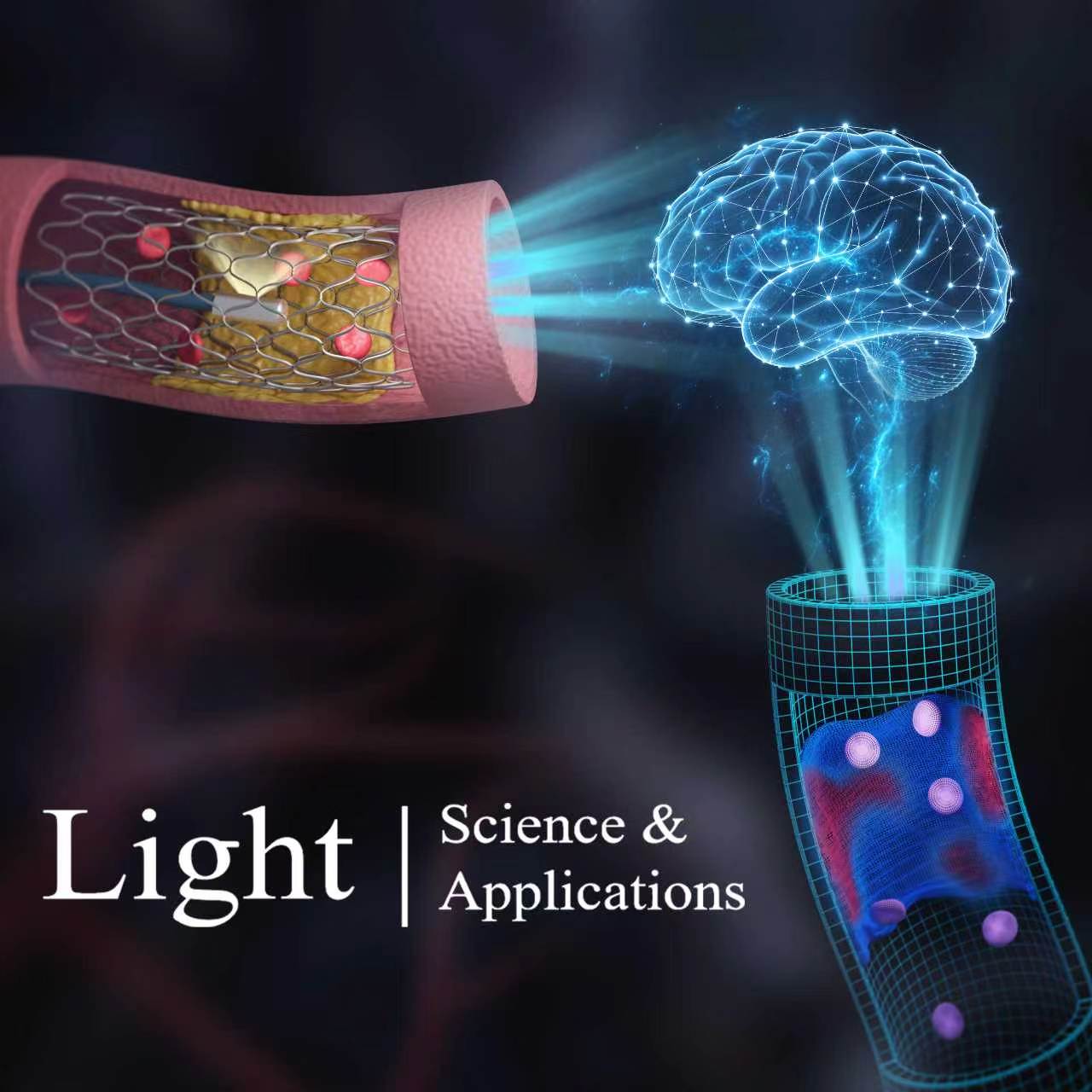 Light: Science & Applications — Intelligent Photonics and Digital Twins in Panvascular Disease